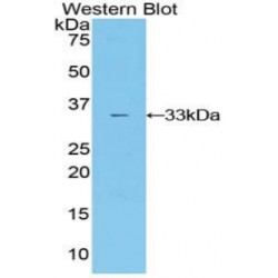 Interleukin 20 Receptor Alpha (IL20Ra) Antibody
