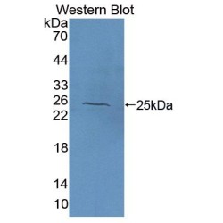 N-Acetylgalactosaminidase Alpha (NAGA) Antibody