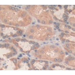 N-Acetylgalactosaminidase Alpha (NAGA) Antibody