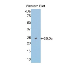 N-Acetylgalactosaminidase Alpha (NAGA) Antibody