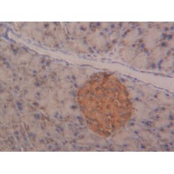 N-Acetylgalactosaminidase Alpha (NAGA) Antibody
