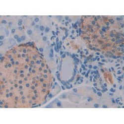 N-Acetylgalactosaminidase Alpha (NAGA) Antibody