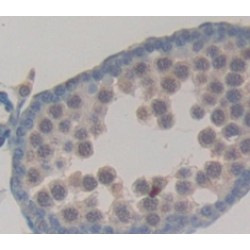 N-Acetylgalactosaminidase Alpha (NAGA) Antibody