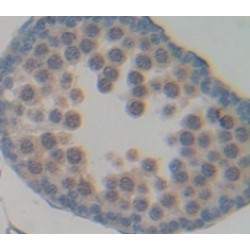 N-Acetylgalactosaminidase Alpha (NAGA) Antibody