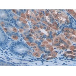 Protein Disulfide Isomerase A2 (PDIA2) Antibody