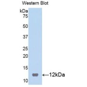 Western blot analysis of the recombinant protein.