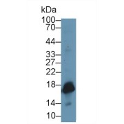Western blot analysis of Rat Uterus lysate, using Rat SOD1 Antibody (1 µg/ml) and HRP-conjugated Goat Anti-Rabbit antibody (<a href="https://www.abbexa.com/index.php?route=product/search&amp;search=abx400043" target="_blank">abx400043</a>, 0.2 µg/ml).