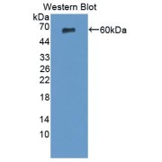 Western blot analysis of the recombinant Human TFPI protein.