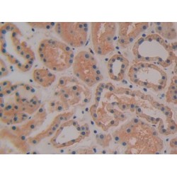 Tissue Factor Pathway Inhibitor (TFPI) Antibody