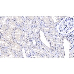 Tissue Factor Pathway Inhibitor (TFPI) Antibody