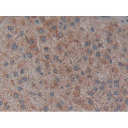 Tissue Factor Pathway Inhibitor (TFPI) Antibody