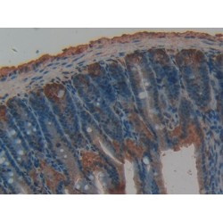 Tissue Factor Pathway Inhibitor (TFPI) Antibody