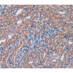 Tissue Factor Pathway Inhibitor (TFPI) Antibody