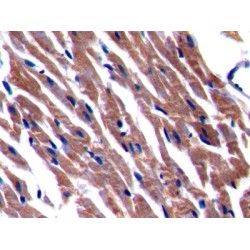 Beta-Site APP Cleaving Enzyme 2 (bACE2) Antibody