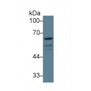 Western blot analysis of Rat Cerebrum lysate, using Rat GAD1 Antibody (2 µg/ml) and HRP-conjugated Goat Anti-Rabbit antibody (<a href="https://www.abbexa.com/index.php?route=product/search&amp;search=abx400043" target="_blank">abx400043</a>, 0.2 µg/ml).