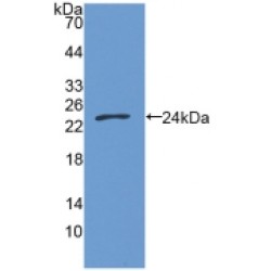 Growth Arrest Specific Protein 6 (GAS6) Antibody