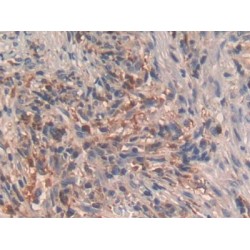 Somatoliberin (GHRH) Antibody