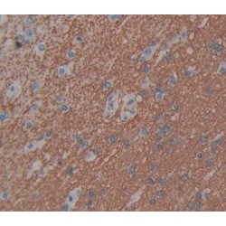 Somatoliberin (GHRH) Antibody