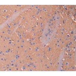 Interleukin 18 Binding Protein (IL18BP) Antibody