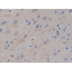 Microtubule Associated Protein 2 (MAP2) Antibody