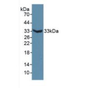 Western blot analysis of recombinant Mouse MAP6.