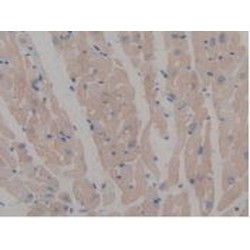 Microtubule Associated Protein 6 (MAP6) Antibody