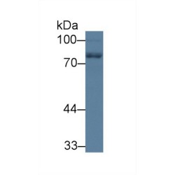 Neurofilament, Light Polypeptide (NEFL) Antibody