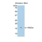 Western blot analysis of recombinant Human NEFL.