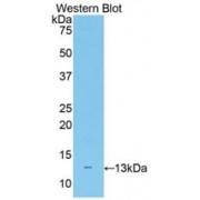 Western blot analysis of recombinant Mouse NEFL Protein.