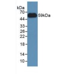 Nicotinamide-N-Methyltransferase (NNMT) Antibody