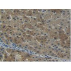 Nicotinamide-N-Methyltransferase (NNMT) Antibody