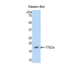 Nicotinamide-N-Methyltransferase (NNMT) Antibody