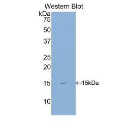 Single Ig IL1 Related Receptor (SIGIRR) Antibody