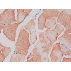 Single Ig IL1 Related Receptor (SIGIRR) Antibody