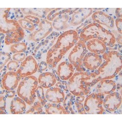 Single Ig IL1 Related Receptor (SIGIRR) Antibody