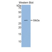 Western blot analysis of recombinant Human SGPL1.