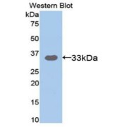 Western blot analysis of the recombinant protein.