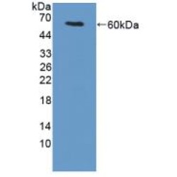 Transglutaminase 1, Keratinocyte (TGM1) Antibody