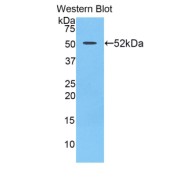 Western blot analysis of the recombinant protein.