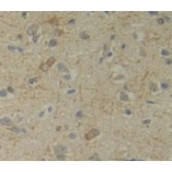 Uracil Phosphoribosyltransferase (UPRT) Antibody