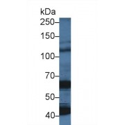 Western blot analysis of Pig Cerebrum lysate, using Human OAS1 Antibody (5 µg/ml) and HRP-conjugated Goat Anti-Rabbit antibody (<a href="https://www.abbexa.com/index.php?route=product/search&amp;search=abx400043" target="_blank">abx400043</a>, 0.2 µg/ml).