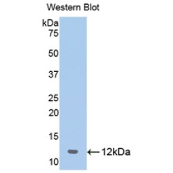 2'-5'-Oligoadenylate Synthetase 1 (OAS1) Antibody