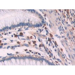 2'-5'-Oligoadenylate Synthetase 1 (OAS1) Antibody