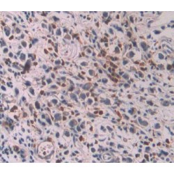 2'-5'-Oligoadenylate Synthetase 1 (OAS1) Antibody