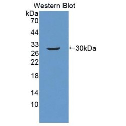Activating Transcription Factor 1 (ATF1) Antibody