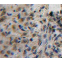Activating Transcription Factor 1 (ATF1) Antibody
