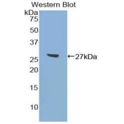 Activating Transcription Factor 7 (ATF7) Antibody