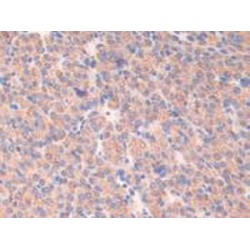 Activating Transcription Factor 7 (ATF7) Antibody