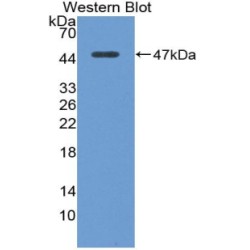 Angiotensin I Converting Enzyme 2 (ACE2) Antibody