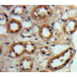 Angiotensin I Converting Enzyme 2 (ACE2) Antibody